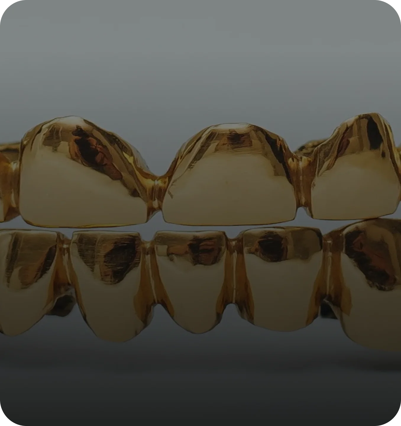 Gold Grillz | Diamond Grillz